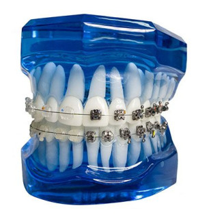 imagem-dental1